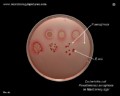 escherichia coli on macconkey